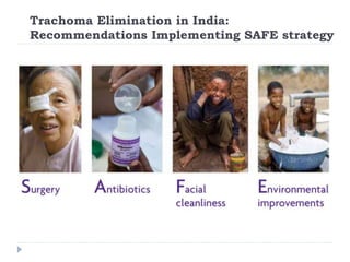 Trachoma Elimination in India:
Recommendations Implementing SAFE strategy
 