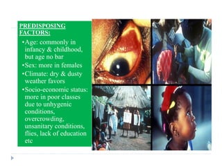 PREDISPOSING
FACTORS:
•Age: commonly in
infancy & childhood,
but age no bar
•Sex: more in females
•Climate: dry & dusty
weather favors
•Socio-economic status:
more in poor classes
due to unhygenic
conditions,
overcrowding,
unsanitary conditions,
flies, lack of education
etc
•Environmental:
exposure to dust,
irritants, smoke,
 