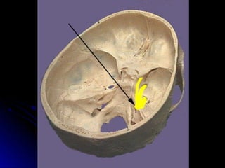 Trigeminal Nerve (Mandibular Division) Introduction