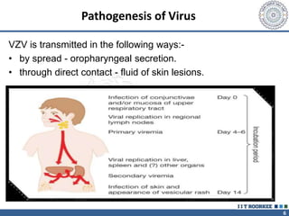 6
Pathogenesis of Virus
VZV is transmitted in the following ways:-
• by spread - oropharyngeal secretion.
• through direct contact - fluid of skin lesions.
 