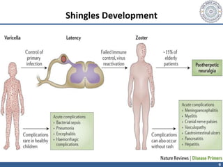 9
Shingles Development
 