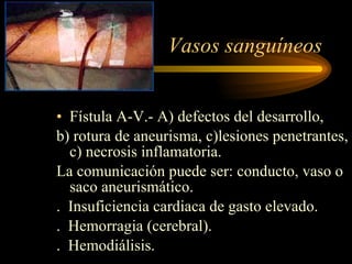 Vasos sanguíneos Fístula A-V.- A) defectos del desarrollo,  b) rotura de aneurisma, c)lesiones penetrantes, c) necrosis inflamatoria. La comunicación puede ser: conducto, vaso o saco aneurismático. .  Insuficiencia cardiaca de gasto elevado. .  Hemorragia (cerebral). .  Hemodiálisis. 