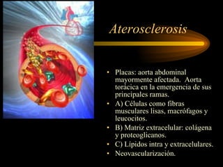 Aterosclerosis Placas: aorta abdominal mayormente afectada.  Aorta torácica en la emergencia de sus principales ramas. A) Células como fibras musculares lisas, macrófagos y leucocitos. B) Matriz extracelular: colágena y proteoglicanos. C) Lípidos intra y extracelulares. Neovascularización. 