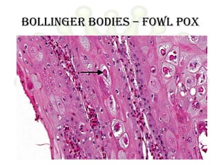 Bollinger bodies – fowl pox
 