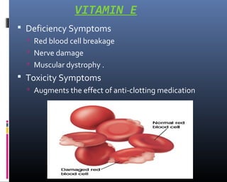 VITAMIN E
 Deficiency Symptoms
 Red blood cell breakage
 Nerve damage
 Muscular dystrophy .
 Toxicity Symptoms
 Augments the effect of anti-clotting medication
 