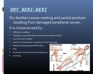 DRY BERI-BERI
Dry beriberi causes wasting and partial paralysis
resulting from damaged peripheral nerves .
It is characterized by :
 Difficulty in walking
 Tingling or loss of sensation (numbness) in hands and feet
 Loss of tendon reflexes
 Loss of muscle function or paralysis of the lower legs
 Mental confusion/speech difficulties
 Pain
 Involuntary eye movements (nystagmus)
 Vomiting.
 