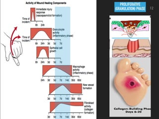 PROLIFERATIVE
(GRANULATION) PHASE 12
 
