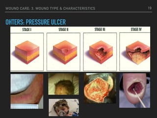 WOUND CARE: 3. WOUND TYPE & CHARACTERISTICS
OHTERS: PRESSURE ULCER
19
 