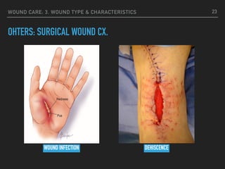 WOUND CARE: 3. WOUND TYPE & CHARACTERISTICS
OHTERS: SURGICAL WOUND CX.
23
WOUND INFECTION DEHISCENCE
 