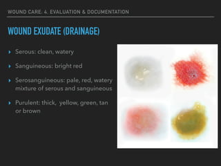 WOUND CARE: 4. EVALUATION & DOCUMENTATION
WOUND EXUDATE (DRAINAGE)
▸ Serous: clean, watery
▸ Sanguineous: bright red
▸ Serosanguineous: pale, red, watery
mixture of serous and sanguineous
▸ Purulent: thick, yellow, green, tan
or brown
 