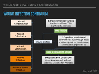 WOUND CARE: 4. EVALUATION & DOCUMENTATION
WOUND INFECTION CONTINUUM
Grey et al, 2005
HAND HYGIENE
FECAL & URINARY MX. SYSTEM
 