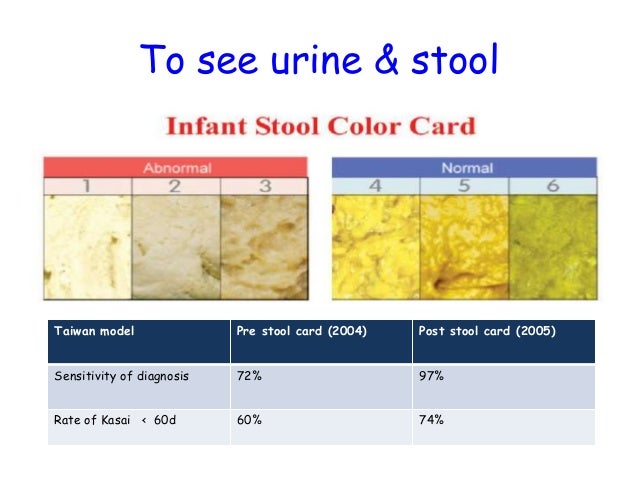 jaundice stool color chart - how to soften newborn stool ...