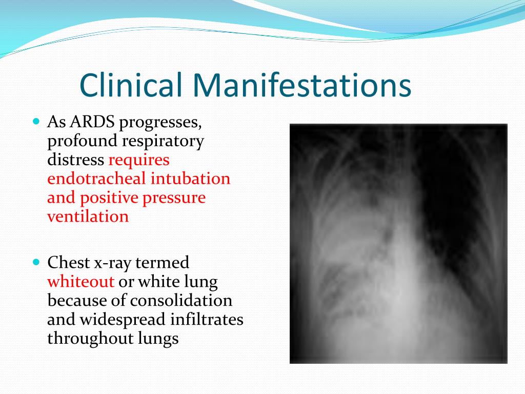 PPT - RESPIRATORY FAILURE and ARDS PowerPoint Presentation, free ...