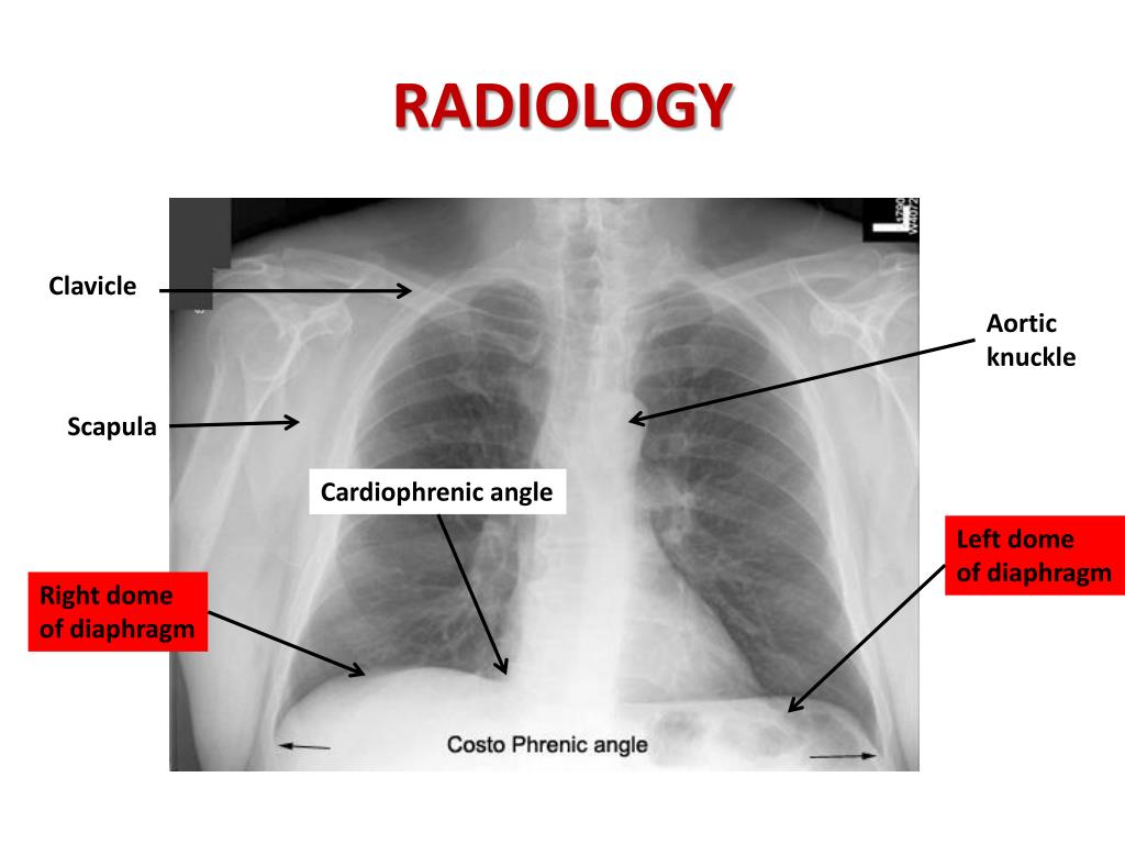 PPT - RESPIRATORY BLOCK PowerPoint Presentation, free download - ID:2055469