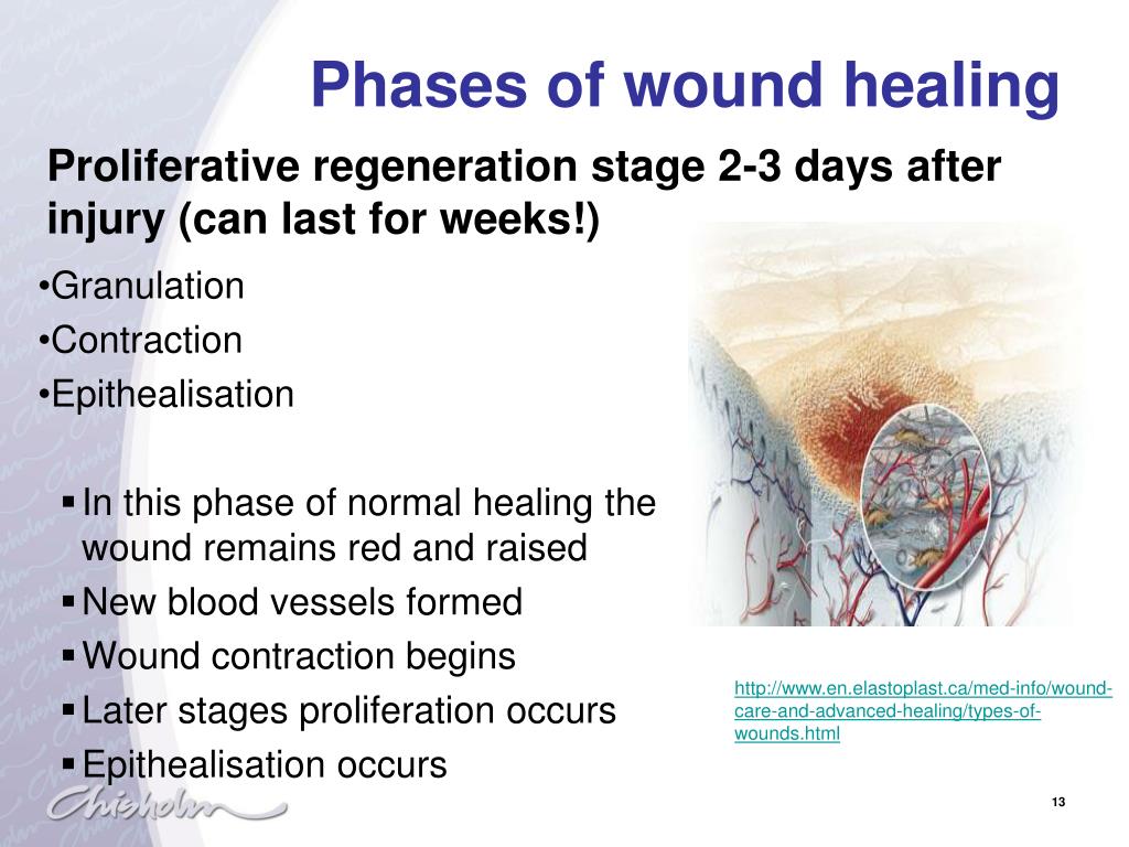 Physiology Of Wound Healing