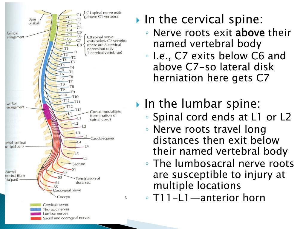 PPT - Radicular Syndrome PowerPoint Presentation, free download - ID ...