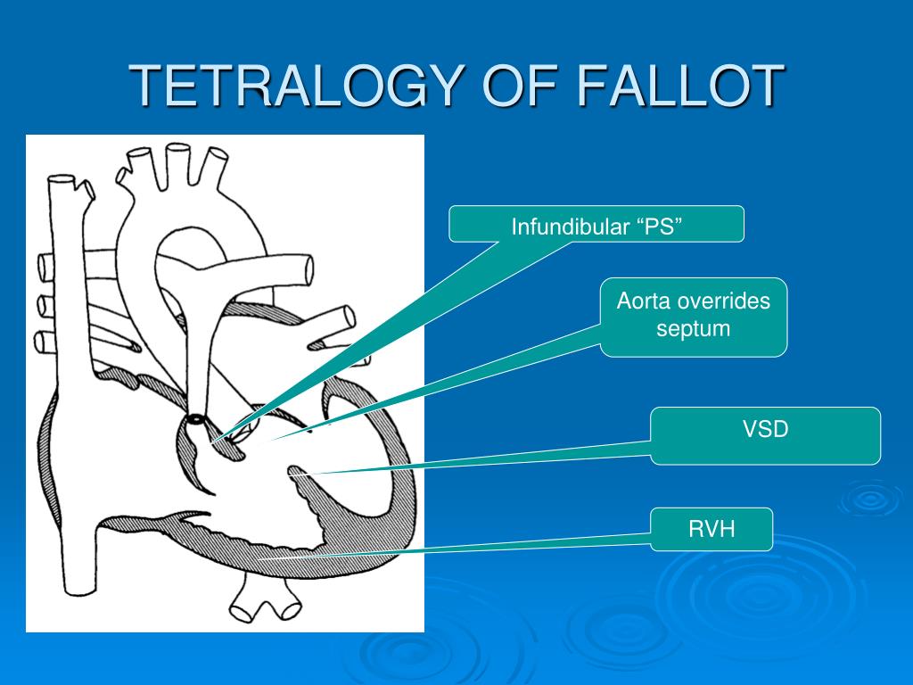 PPT - Basic Approach to cyanosis in infancy PowerPoint Presentation ...