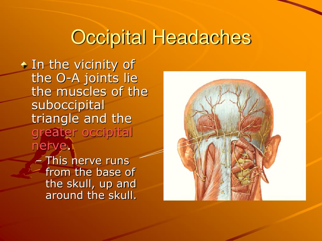 Occipital Neuralgia Explained Migraines Occipital Headaches – NBKomputer