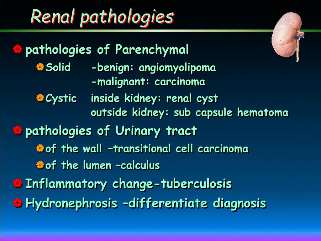 PPT - Urinary system: imaging diagnosis PowerPoint Presentation, free ...