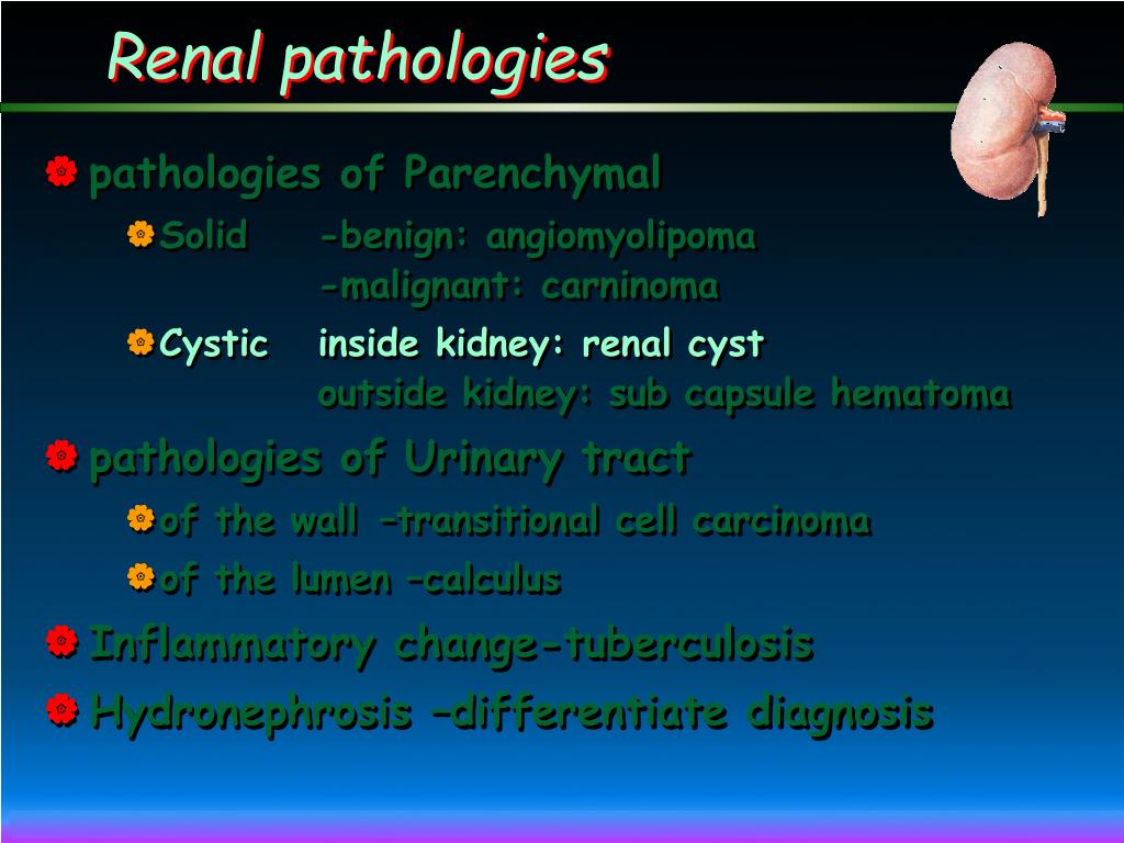 PPT - Urinary system: imaging diagnosis PowerPoint Presentation, free ...