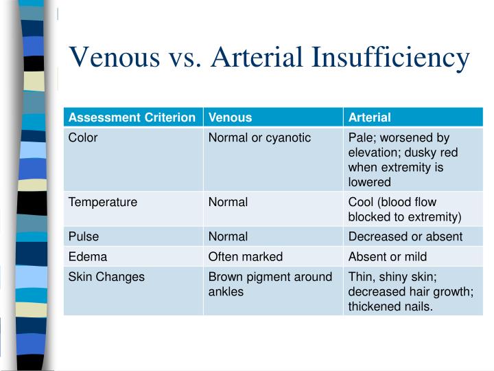 Arterial Vs Venous Disease