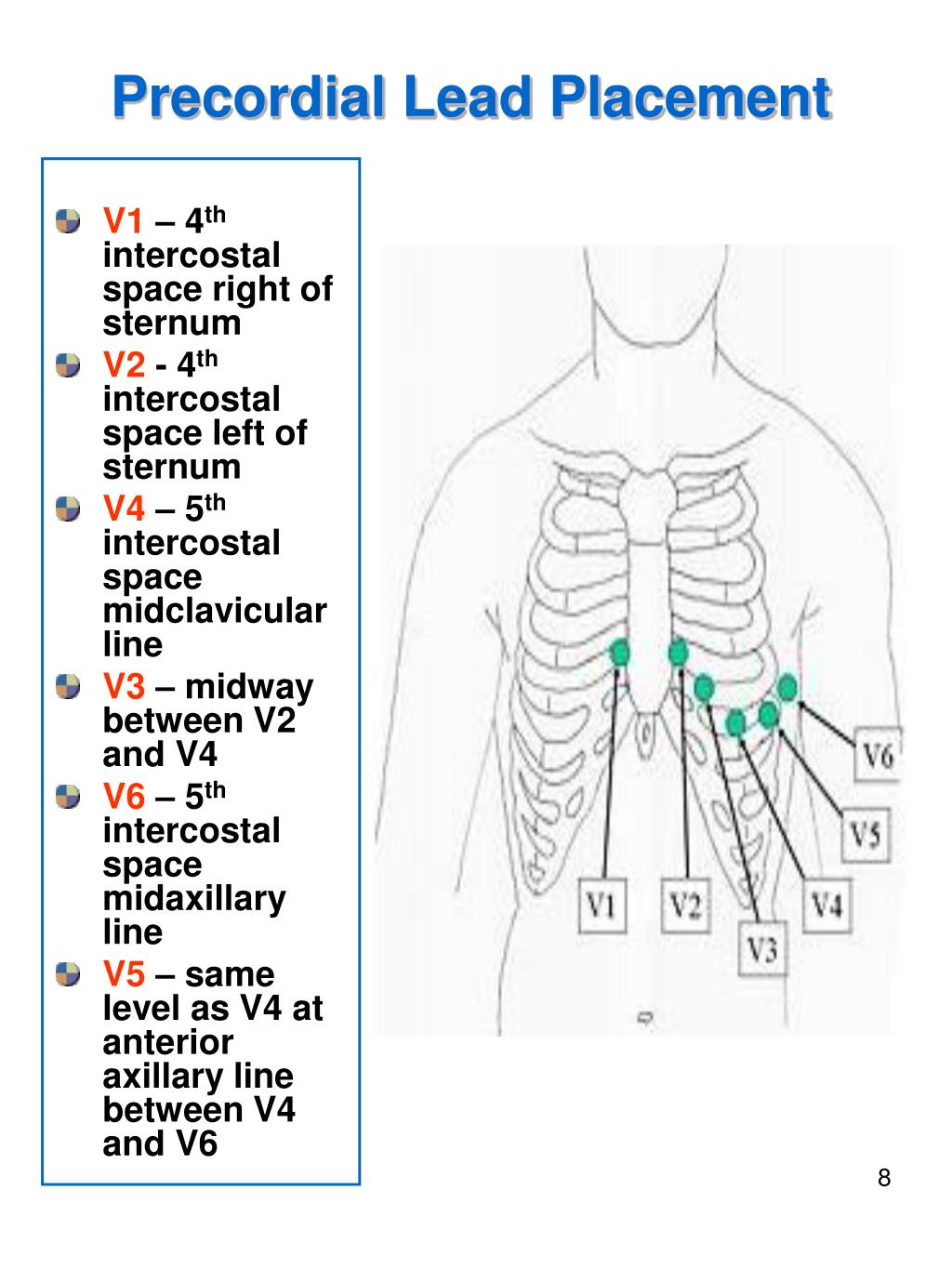 Ecg Normal V1 V2 V3 V4 V5 V6 - BRAINCP