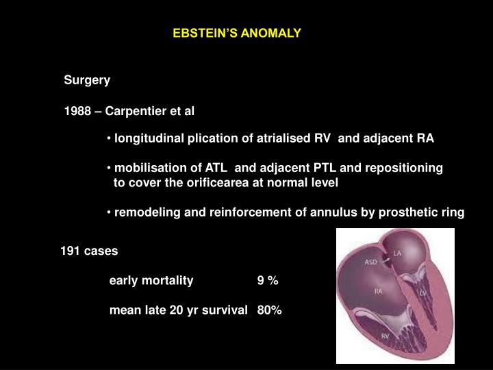 PPT - EBSTEIN'S ANOMALY OF TRICUSPID VALVE PowerPoint Presentation - ID ...