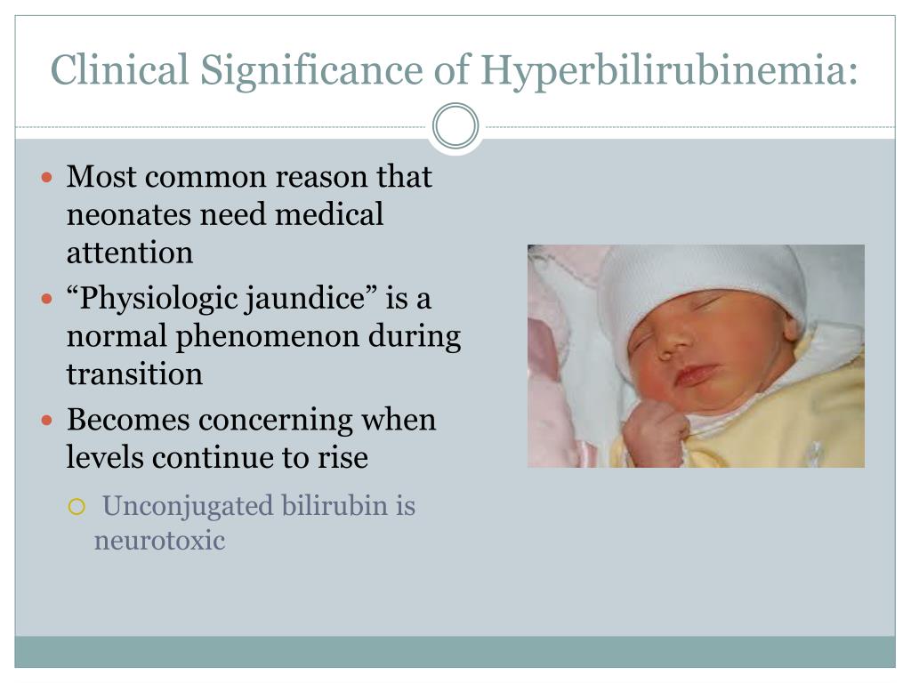 Hyperbilirubinemia Neonatal Neonatal Hyperbilirubinem - vrogue.co