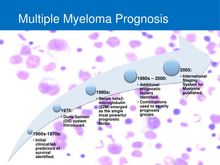 Jeffrey Underwood Info: Multiple Myeloma Prognosis 2021