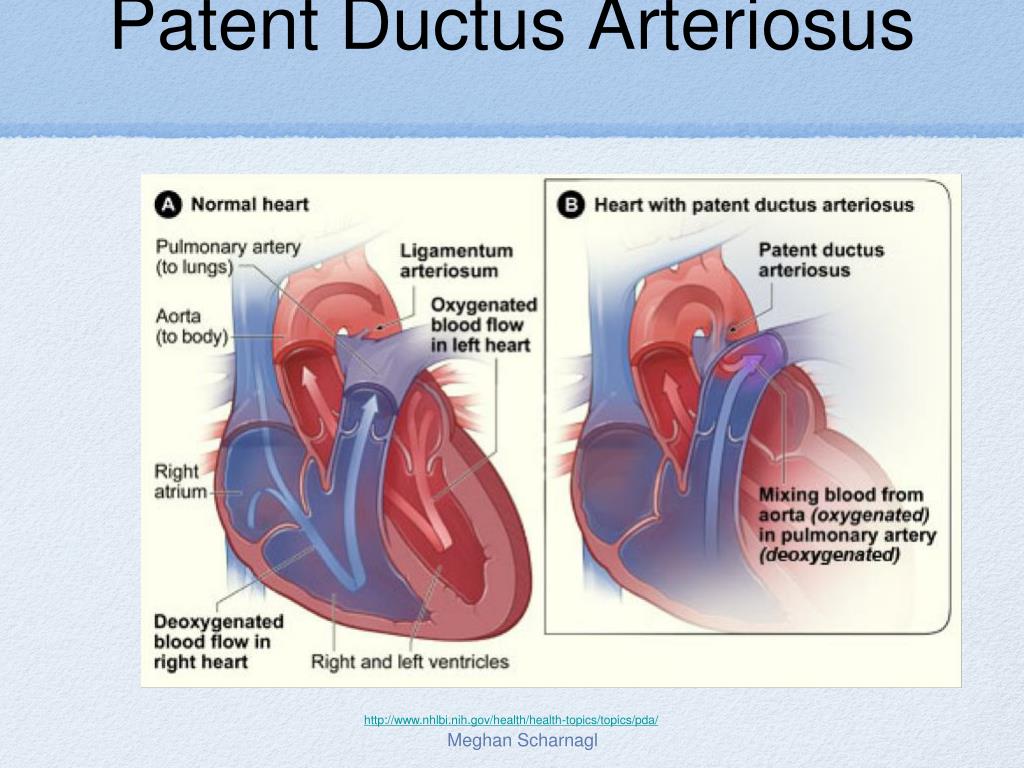 PPT - fetal Circulation PowerPoint Presentation, free download - ID:5388525