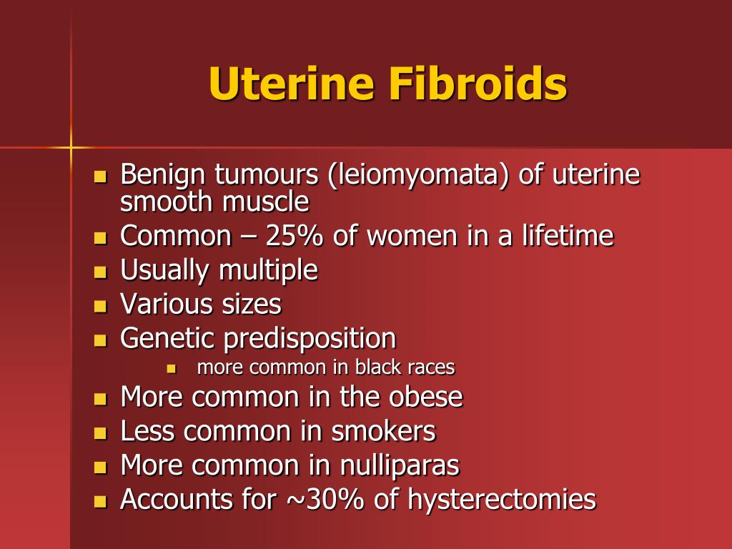 PPT - Uterine Fibroids PowerPoint Presentation, free download - ID:6082086