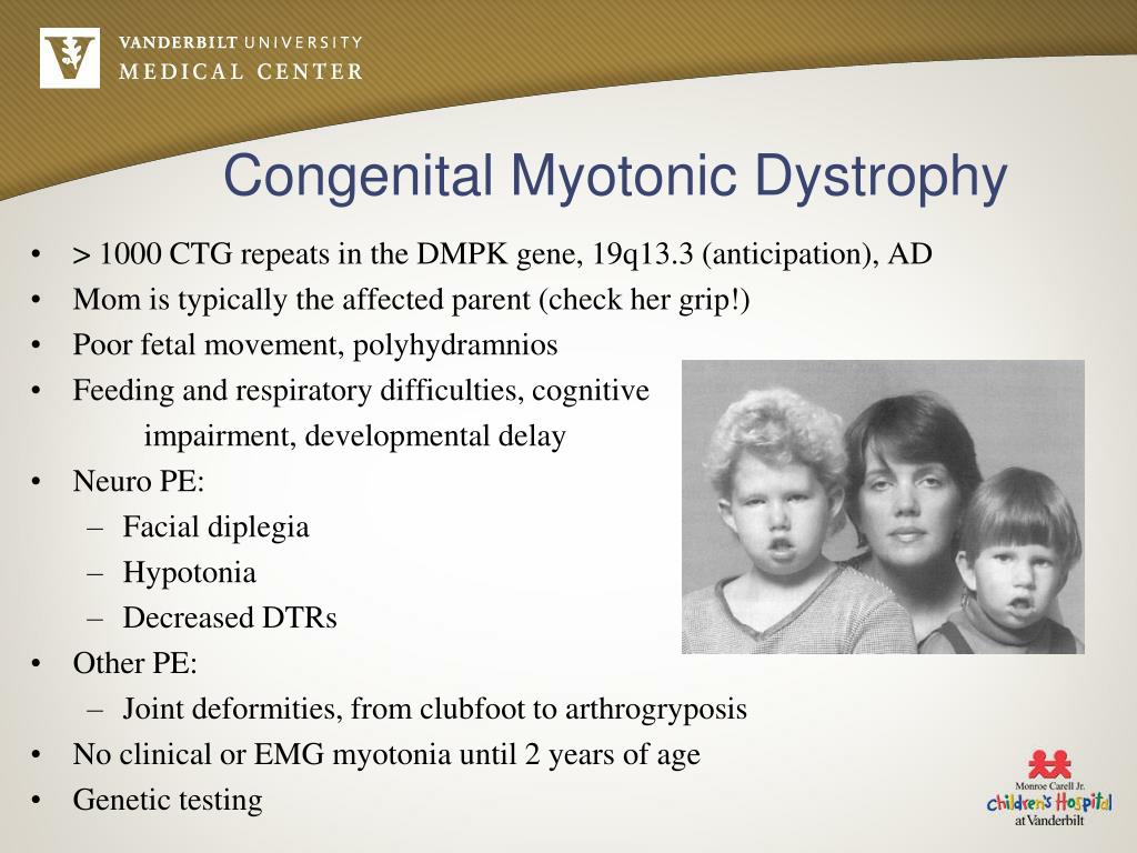 PPT - Muscle Disease PowerPoint Presentation, free download - ID:6660206