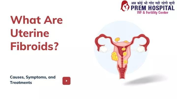 PPT - What Are Uterine Fibroids PowerPoint Presentation, free download ...