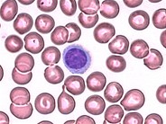 Plasmacytoid lymphocyte - 1.