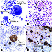 Mesothelial Cells