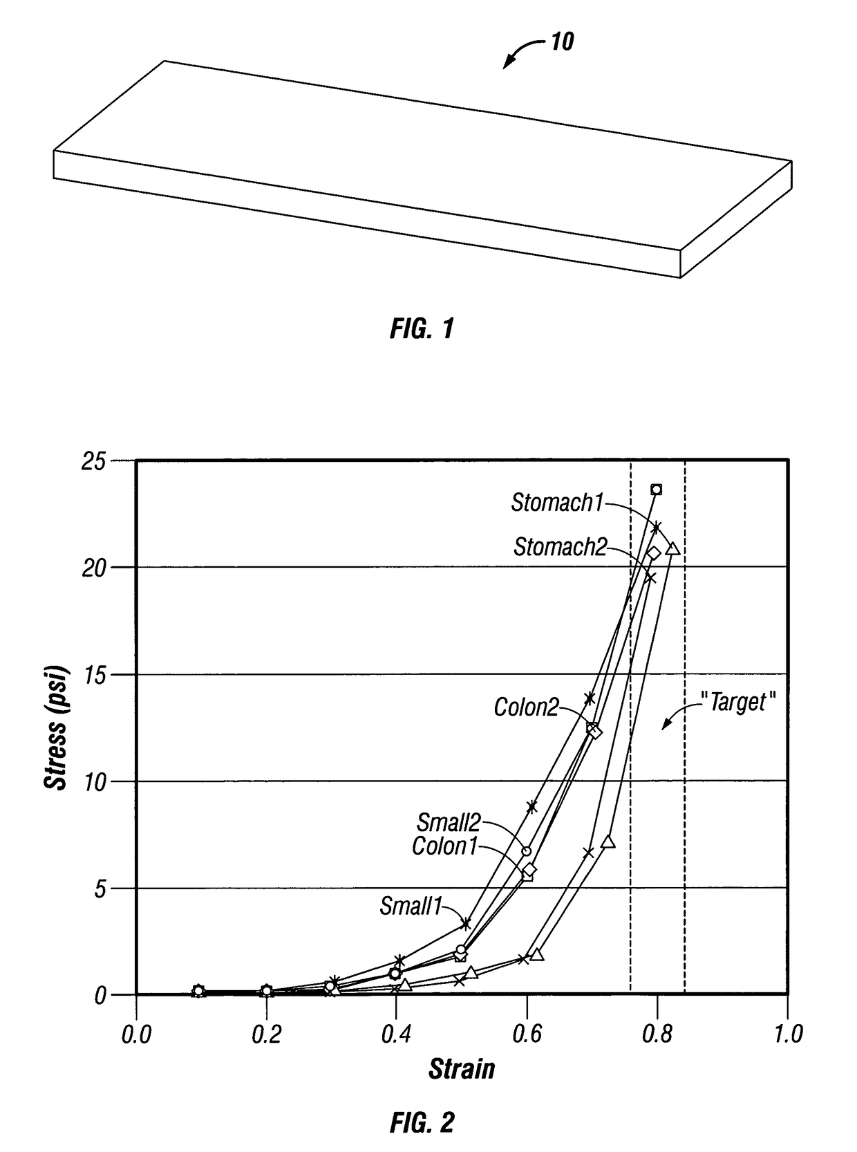 Mechanically tuned buttress material to assist with proper formation of surgical element in diseased tissue