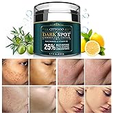 CITYGOO Dark Spot Remover for Face and Body, Corrector Cream, Natural Ingredient,Enriching Skin Care For All Skin Tones - Mel