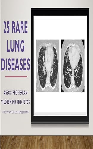 Understanding 25 RARE DISEASES – LUNG: Decoding the Mysteries of Rare ...