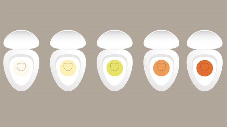 What Do the Color and Smell of Your Urine Tell You?