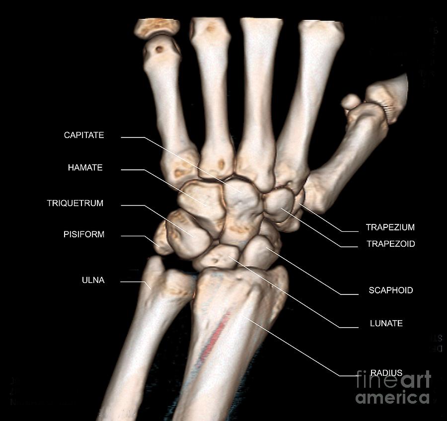 Normal Wrist X Ray