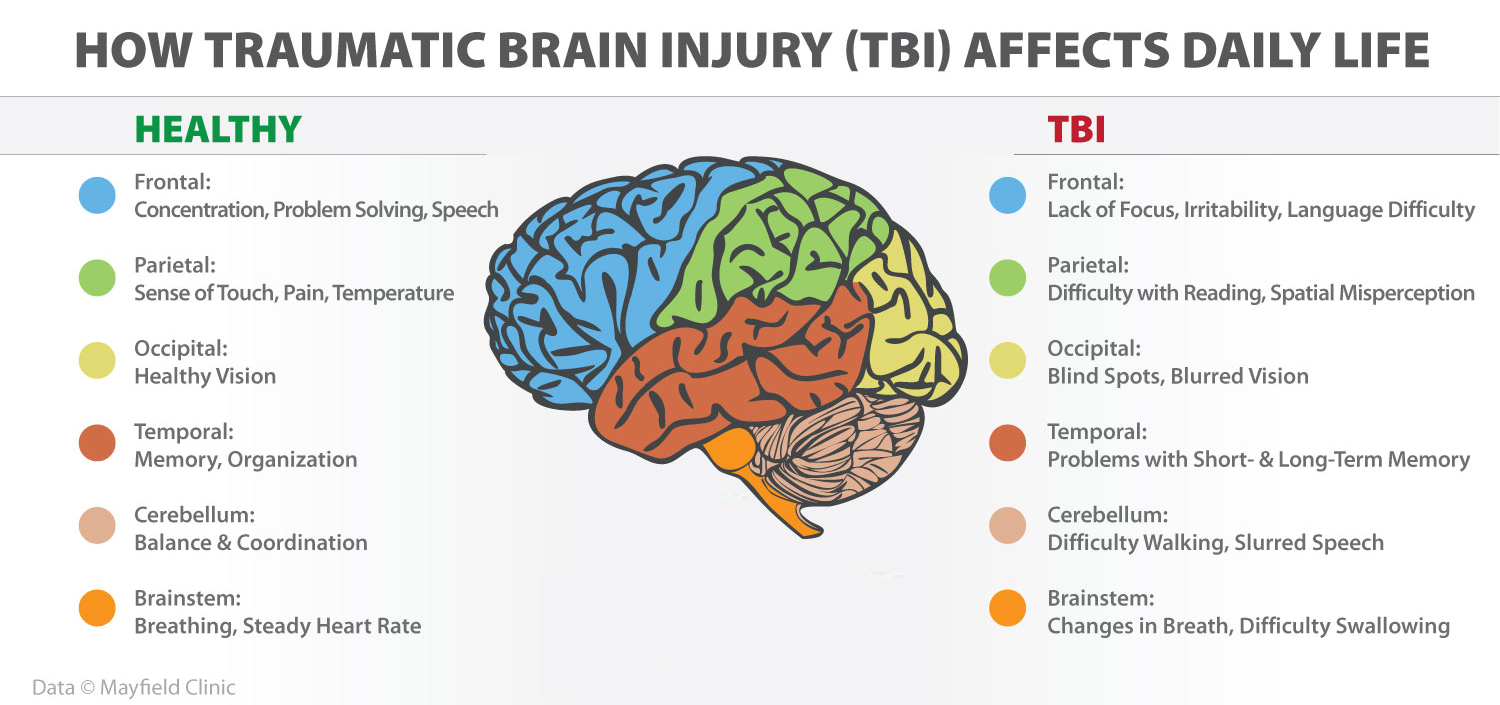 Long-Term Care Facilities For Traumatic Brain Injury at Barbara Turner blog