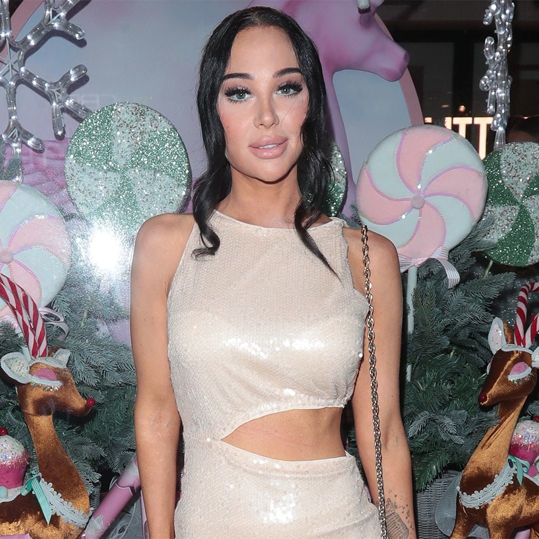 Tulisa's facial surgery 'confession': what has star done to her face