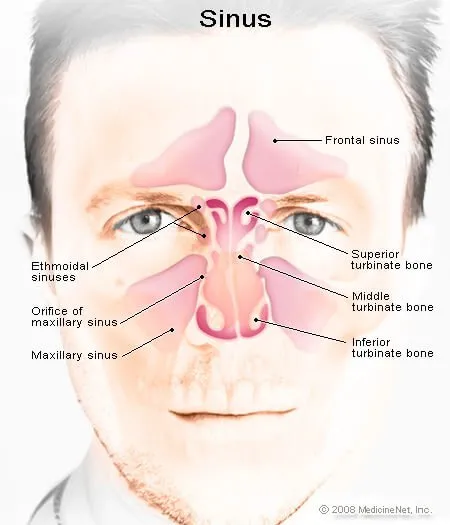 Chronic Rhinitis Post Nasal Drip Treatment Symptoms Cure