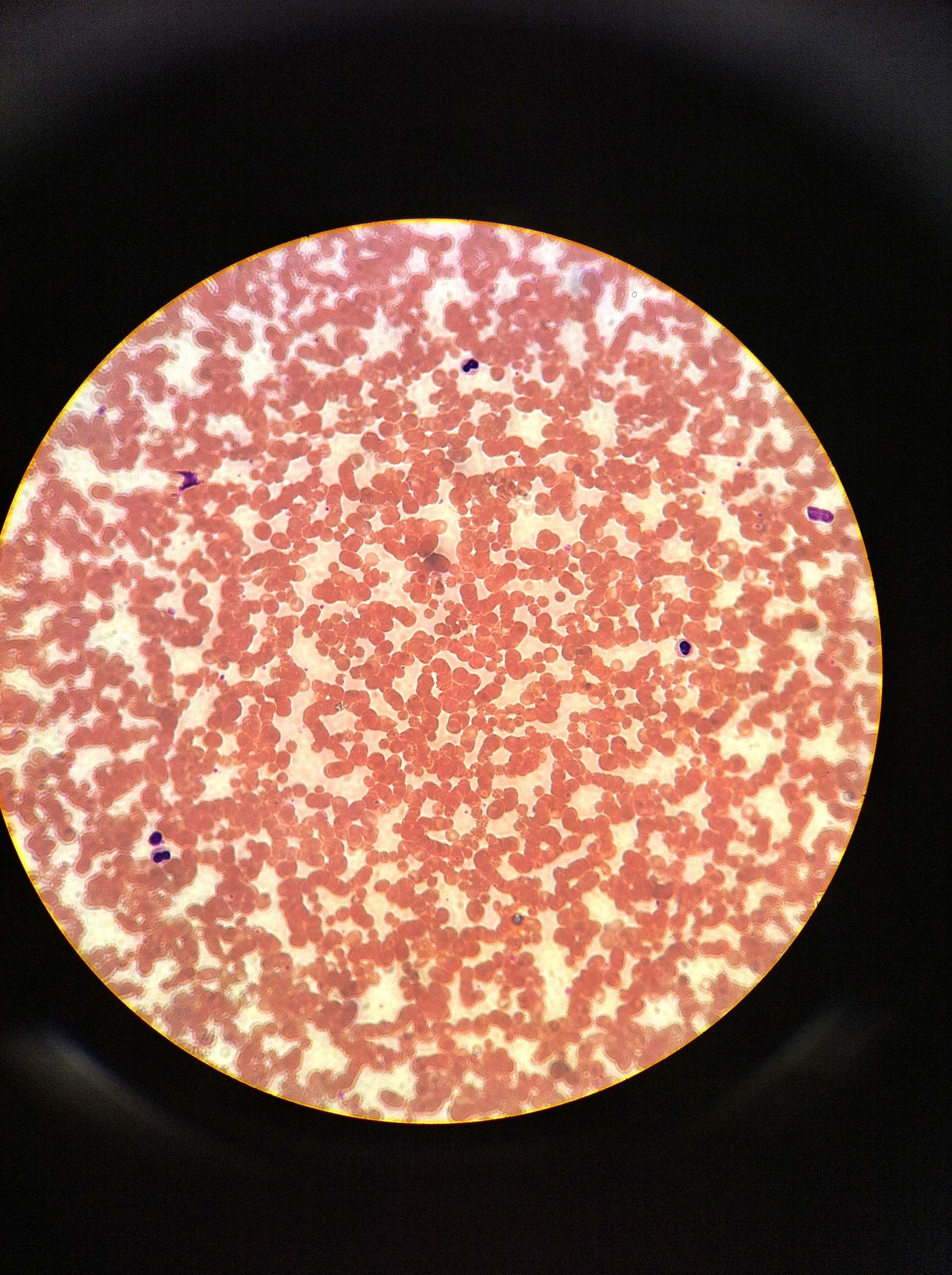 Blood (Wrights stain) Total Mag: 400X