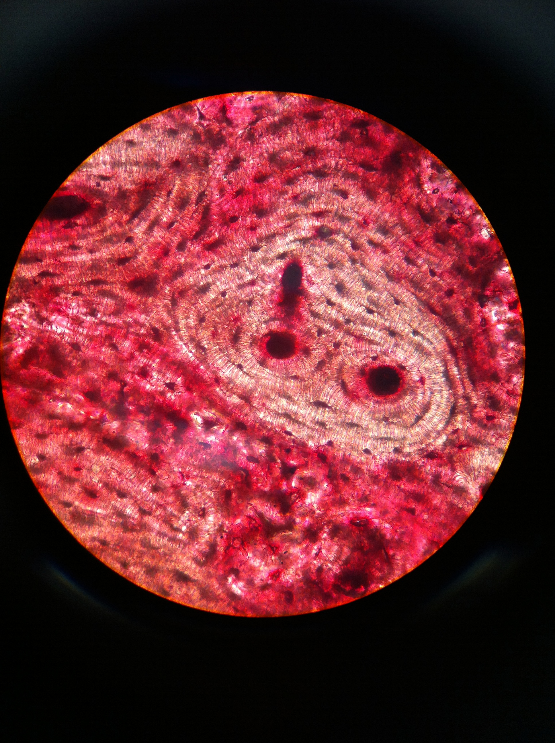 Compact Bone, calcified (xs), Total Mag: 400X