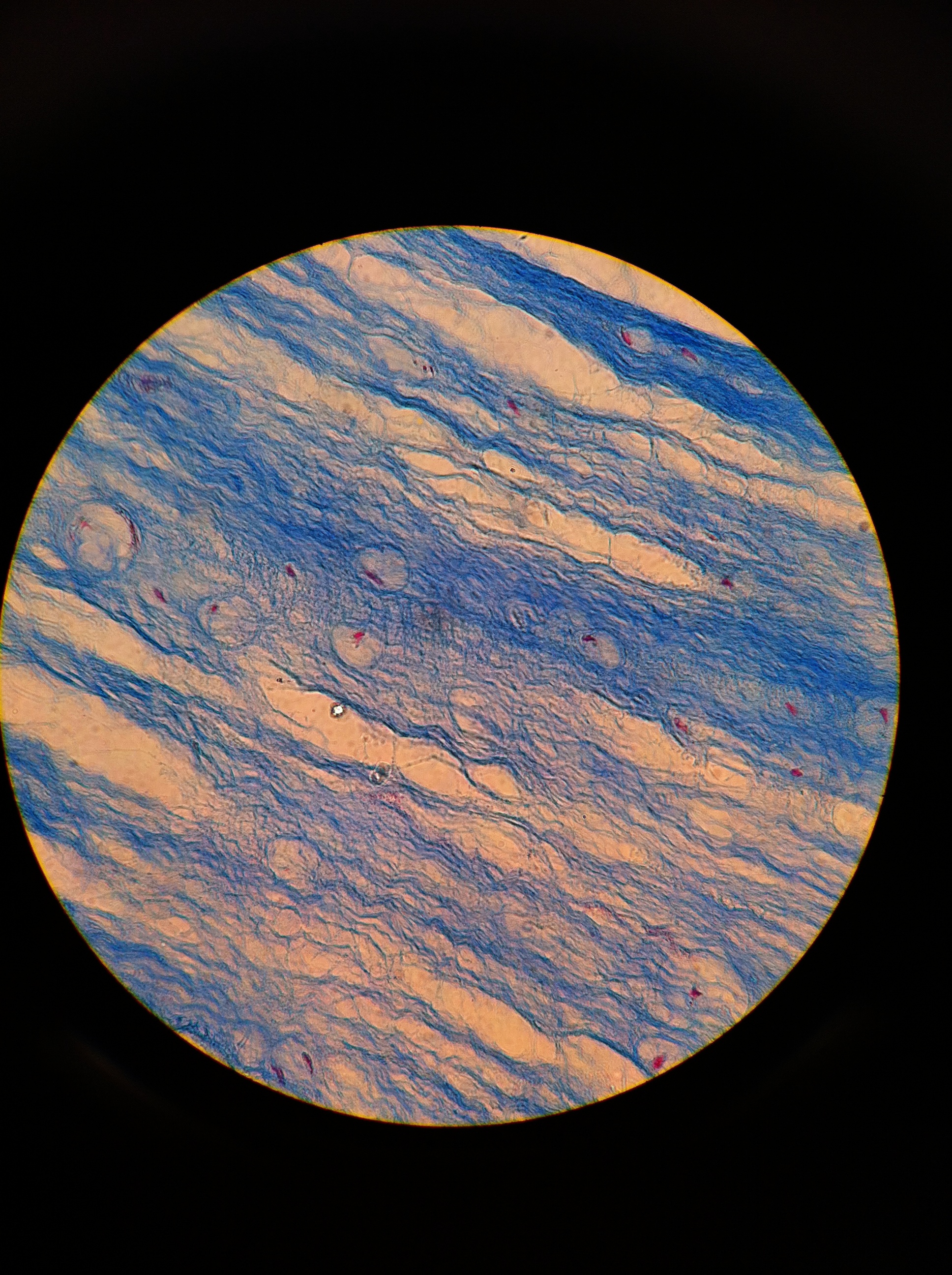 Fibrocartilage, Total Mag: 400X