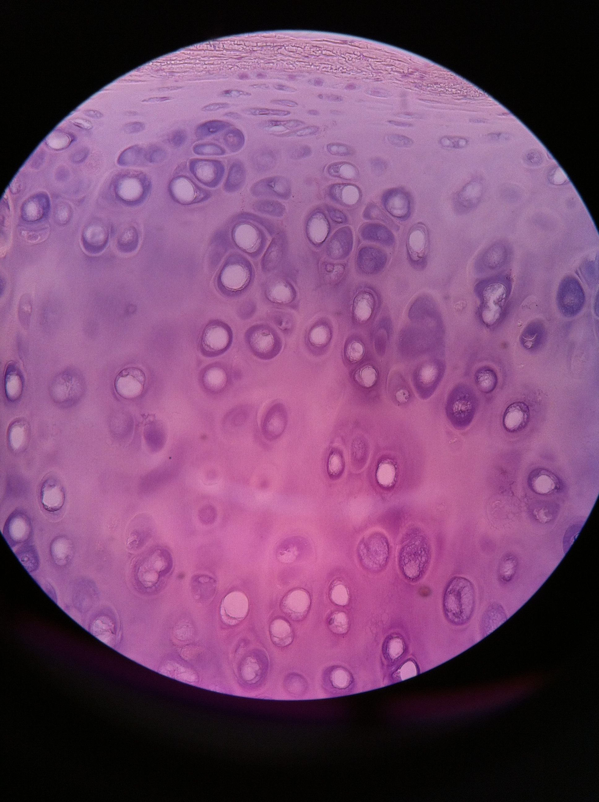 Hyaline cartilage, Total Mag: 400X