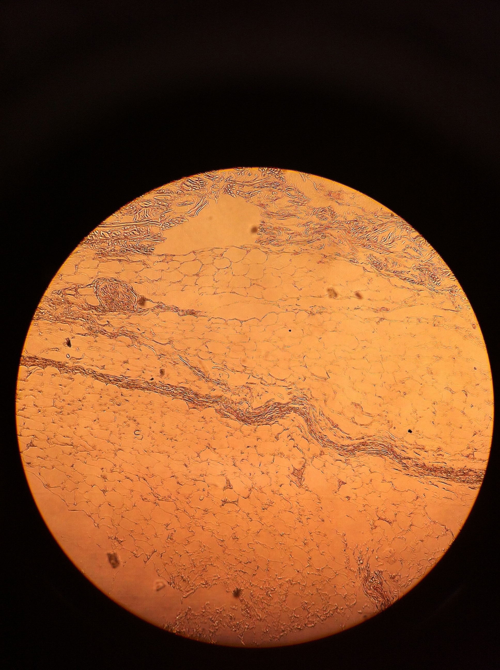 adipose (hypodermis), Total Mag: 100X