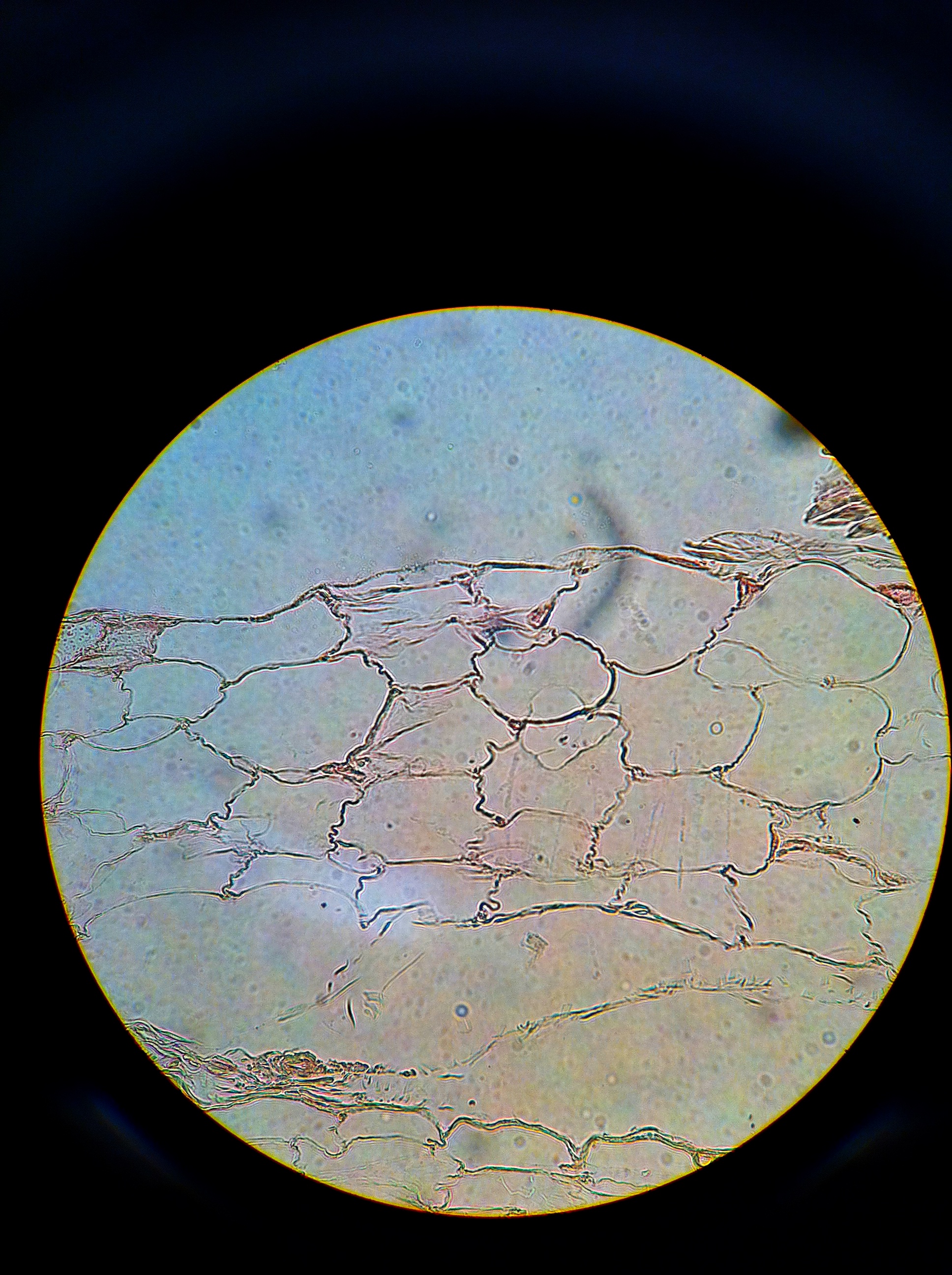 Adipose (hypodermis), Total Mag: 400X