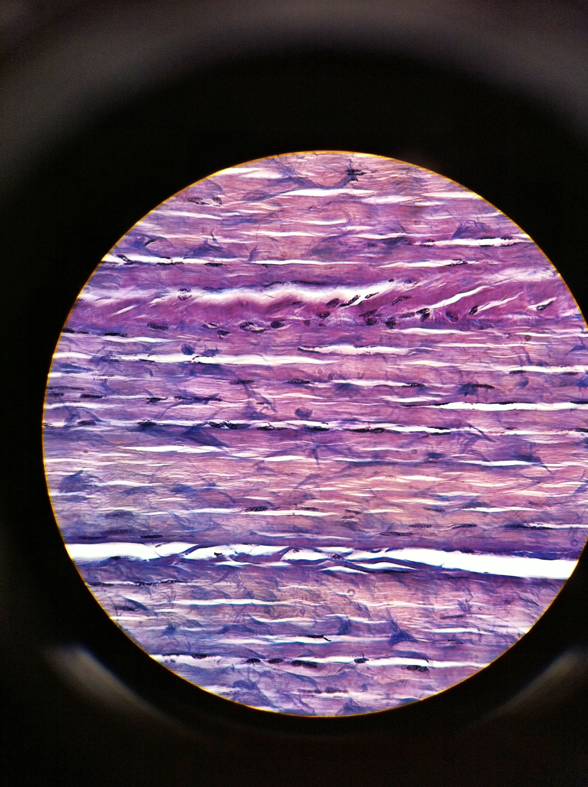 dense regular (white fibrous tissue), Total Mag: 400X